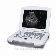 Equipo médico del ordenador portátil DW-500 / precio portátil de la máquina del ultrasonido